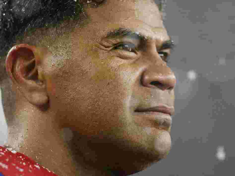 The brain of former NFL star Junior Seau, who committed suicide last year, showed signs of the kind of neurodegenerative disease associated with repetitive head trauma.