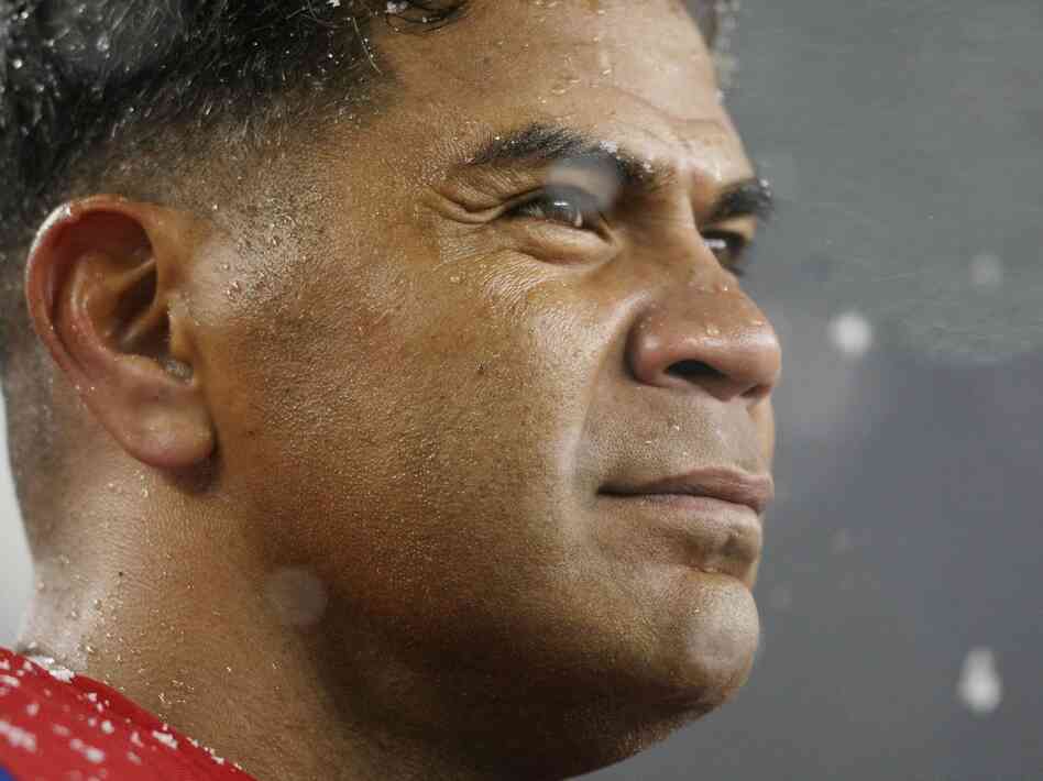 The brain of former NFL star Junior Seau, who committed suicide last year, showed signs of the kind of neurodegenerative disease associated with repetitive head trauma.
