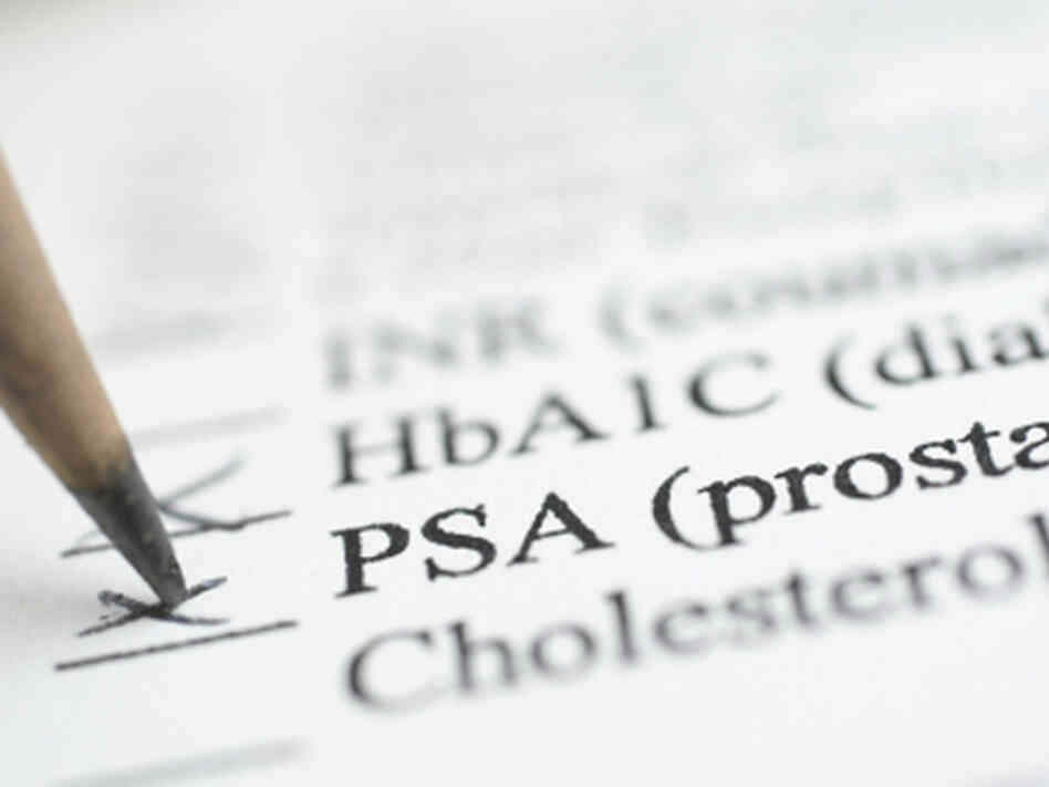 When is the right time to check the PSA box? When is the right time to check the PSA box?