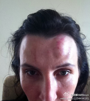 domestic violence is a serious problem
