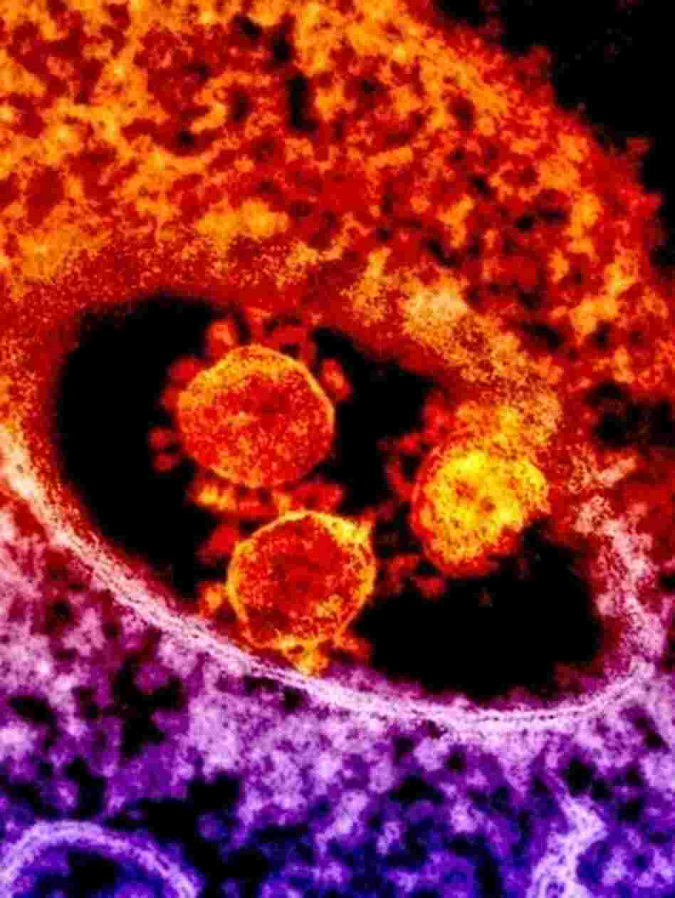 Virologists discovered the new coronavirus after it killed a Saudi Arabian man last summer. Virologists discovered the new coronavirus after it killed a Saudi Arabian man last summer.