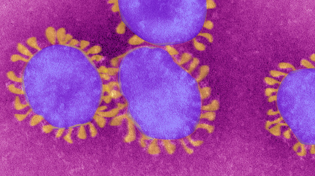 Coronaviruses have a characteristic crown of tentacles when viewed under the electron microscope.
