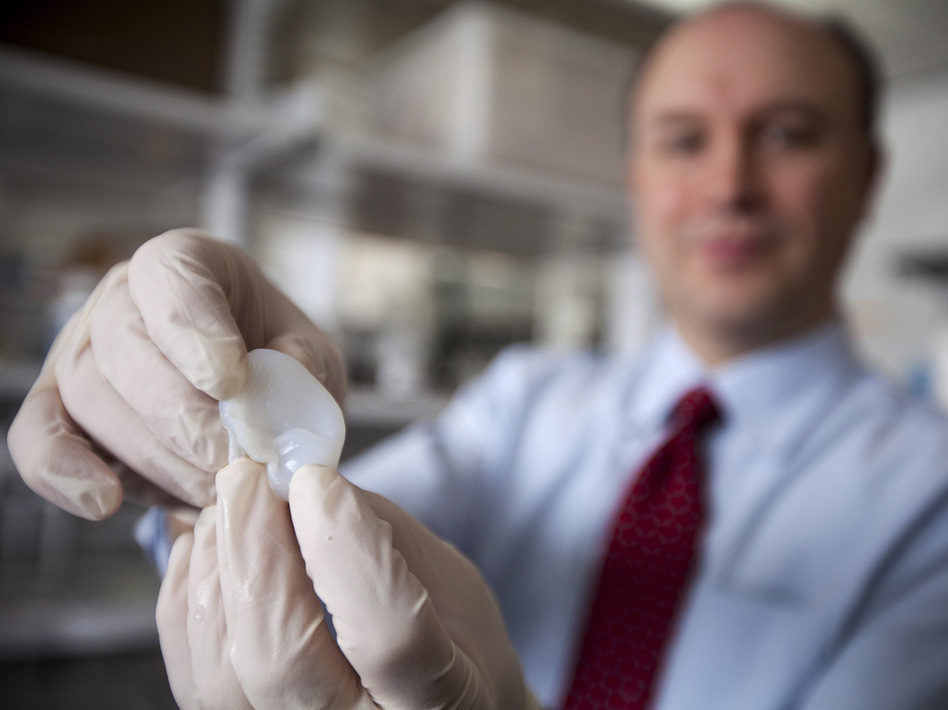 Larry Bonassar shows off an ear  that he and his colleagues at Cornell University built out of living cartilage cells with the help of a 3-D printer.