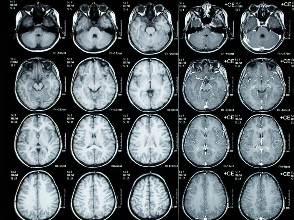 Scans shouldn't be ordered routinely for kids with minor head injuries, new advice to doctors says.