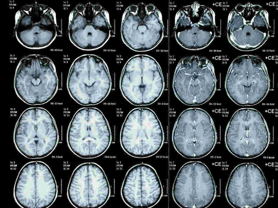 Scans shouldn't be ordered routinely for kids with minor head injuries, new advice to doctors says.