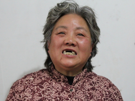 Shen Lixiu, 58, says she had her front teeth kicked out in a re-education through labor camp. Chinese authorities say they are considering "reforms" to a system that is coming under increasing public criticism.