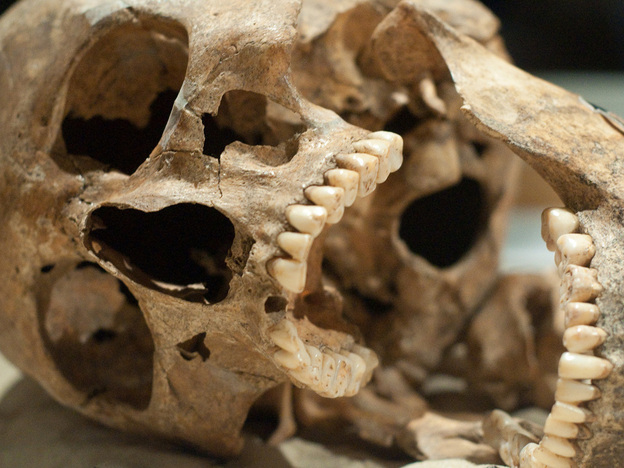 This skull may have better teeth than you.