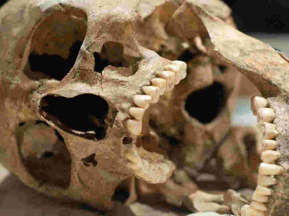 This skull may have better teeth than you.