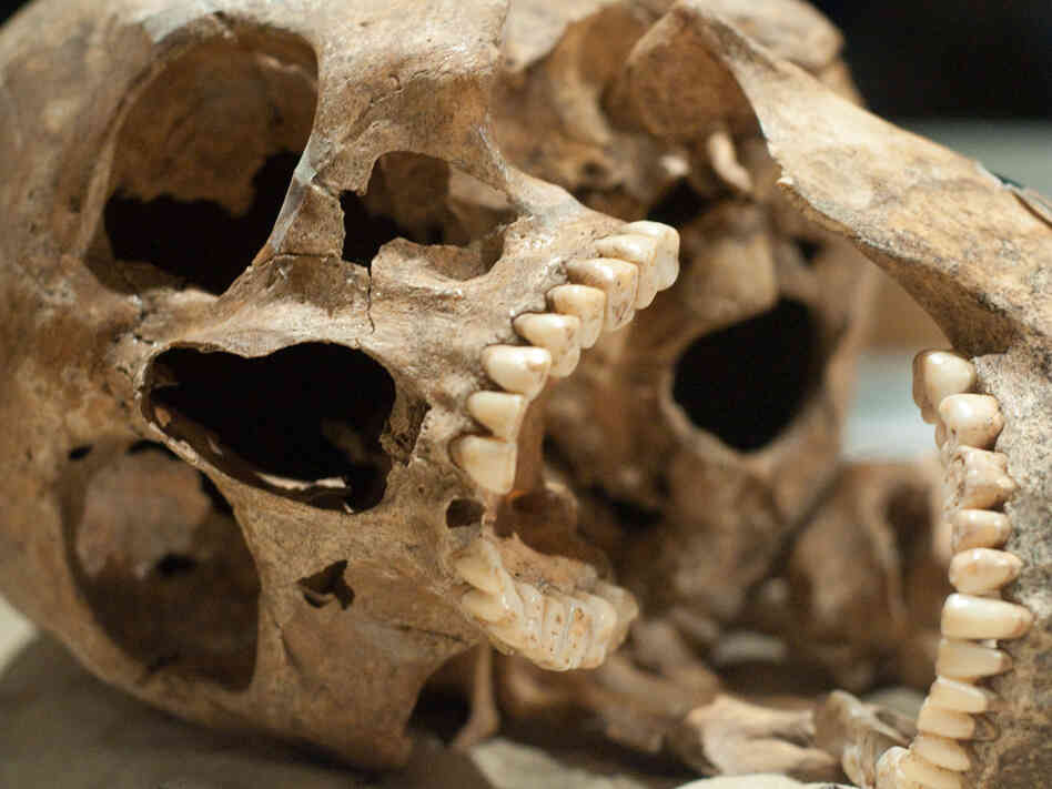 This skull may have better teeth than you.