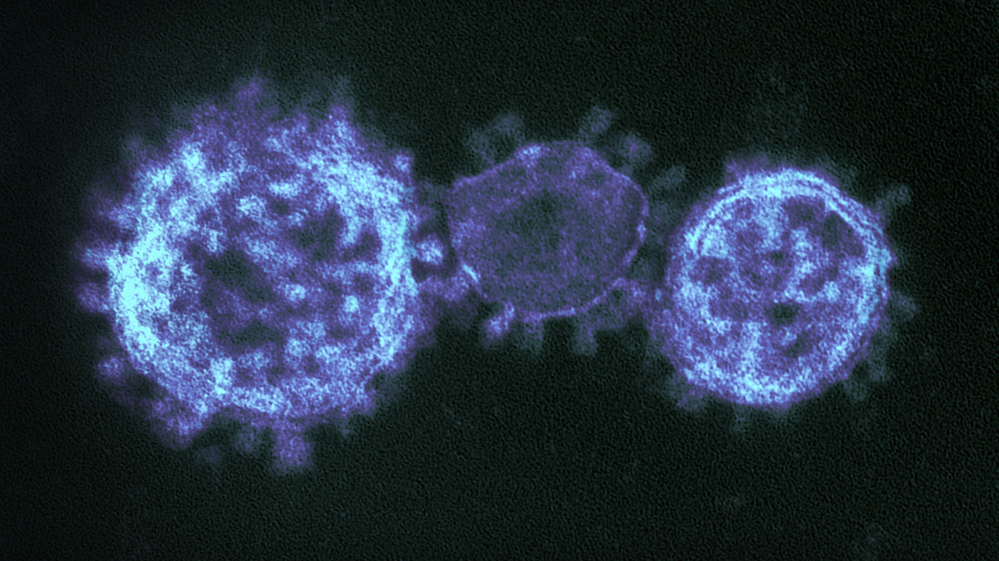 A new coronavirus looks a lot like its cousin SARS under the microscope, but it appears they're quite different when it comes to contagiousness.