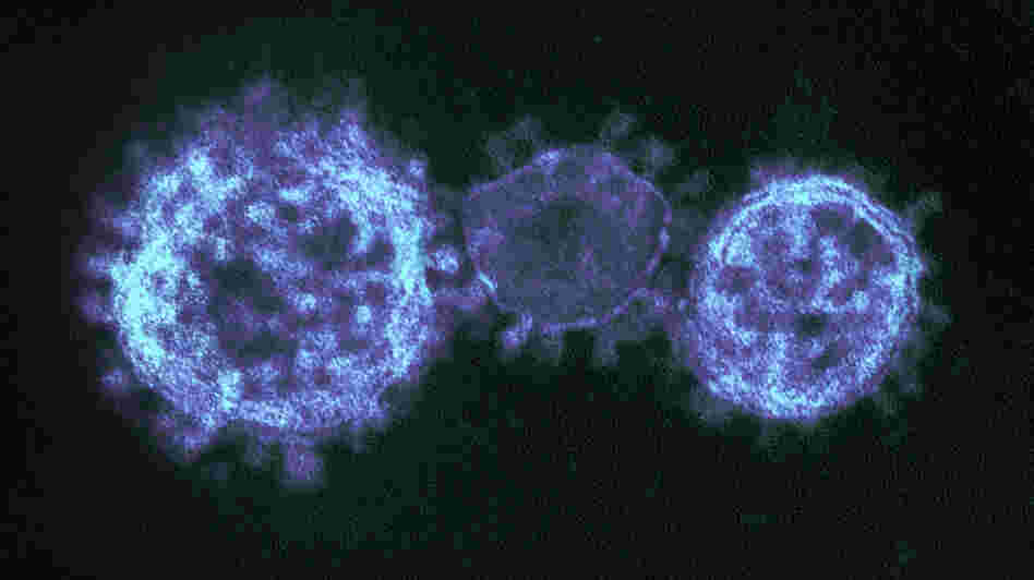 A new coronavirus looks a lot like its cousin SARS under the microscope, but it appears they're quite different when it comes to contagiousness.