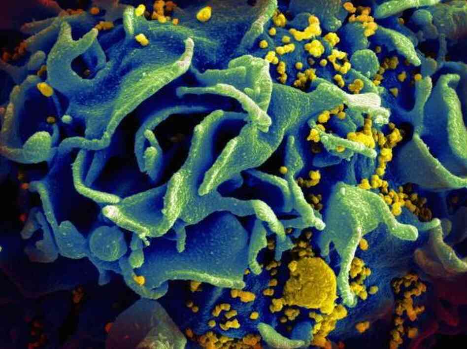 HIV particles, yellow, infect an immune cell, blue.