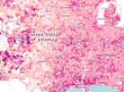 The average travel time to work in the United States tops 25 minutes, according to the U.S. Census Bureau. Move around the map or enter your town or zip code to find commute times for your area.