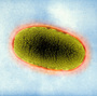 Klebsiella pneumoniae, seen here with an electron microscope, are the most common superbugs causing highly drug-resistant infections in hospitals. Klebsiella pneumoniae, seen here with an electron microscope, are the most common superbugs causing highly drug-resistant infections in hospitals.