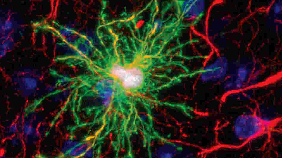 This image shows a human glial cell (green) among normal mouse glial cells (red). The human cell is larger, sends out more fibers and has more connections than do mouse cells. Mice with this type of human cell implanted in their brains perform better on learning and memory tests than do typical mice.