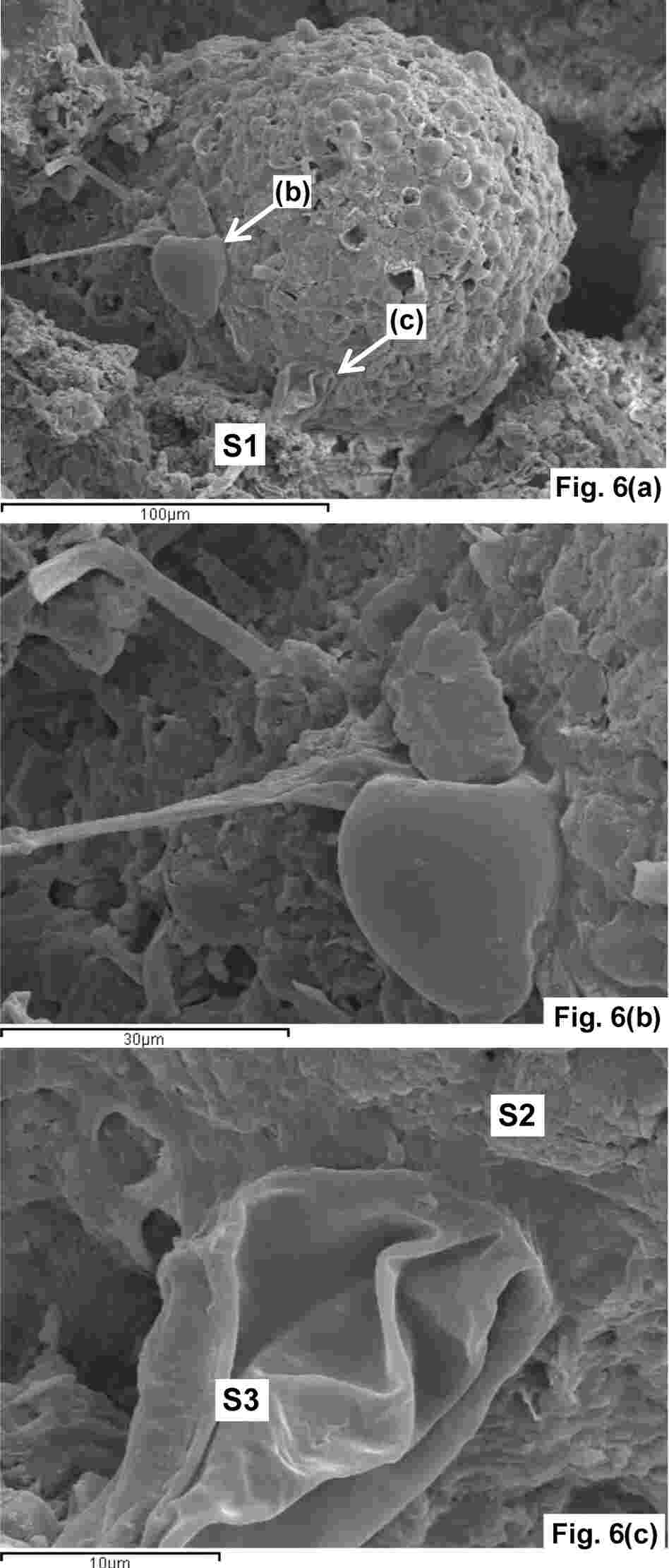 Images show what researchers say could be a "hystrichosphere," a fossilized dinoflagellate cyst.