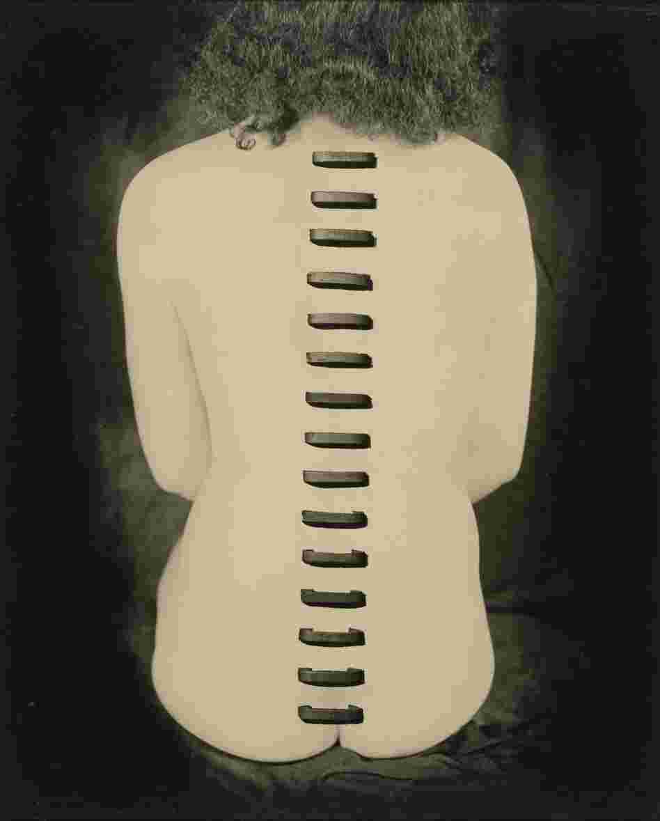 Stapled Flesh, 1949