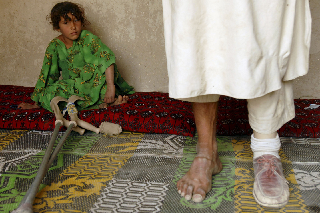 Abdul Malak, who lost his leg in a mine blast during grazing, stands on a prosthetic limb — with his daughter nearby — in a Parwan province village north of Kabul, 2008. Abdul Malak, who lost his leg in a mine blast during grazing, stands on a prosthetic limb — with his daughter nearby — in a Parwan province village north of Kabul, 2008.