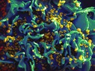 An electron micrograph of HIV particles infecting a human T cell. French researchers say they've found 14 patients with so little HIV virus in their blood that the patients have gone into "long-term remission." An electron micrograph of HIV particles infecting a human T cell. French researchers say they've found 14 patients with so little HIV virus in their blood that the patients have gone into "long-term remission."