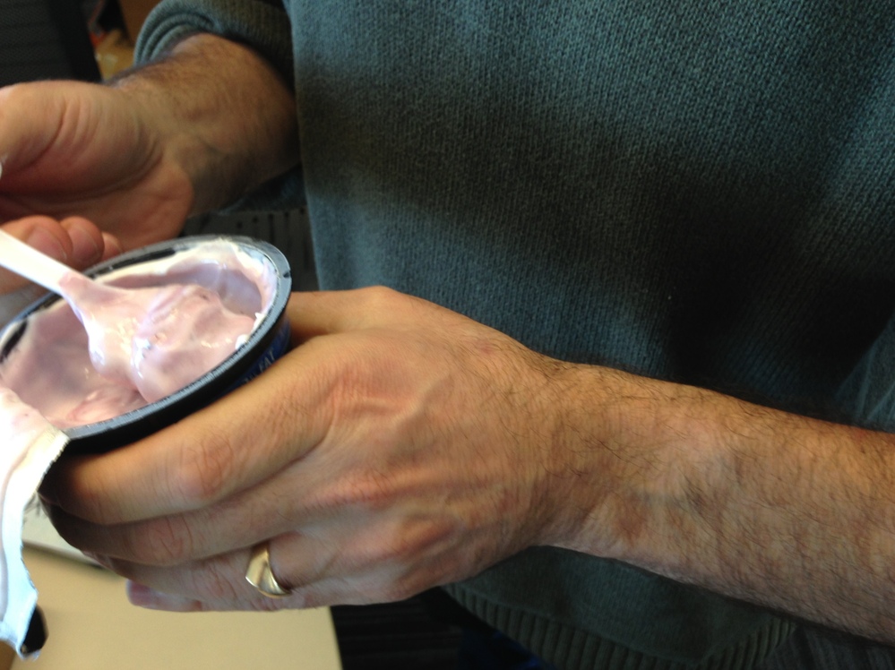 The amazing thing: Peter's arm was completely hairless before trying this yogurt.
