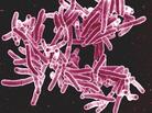 About a third of the world's population is thought to be infected with Mycobacterium tuberculosis, but only a small fraction of people get the disease. About a third of the world's population is thought to be infected with Mycobacterium tuberculosis, but only a small fraction of people get the disease.