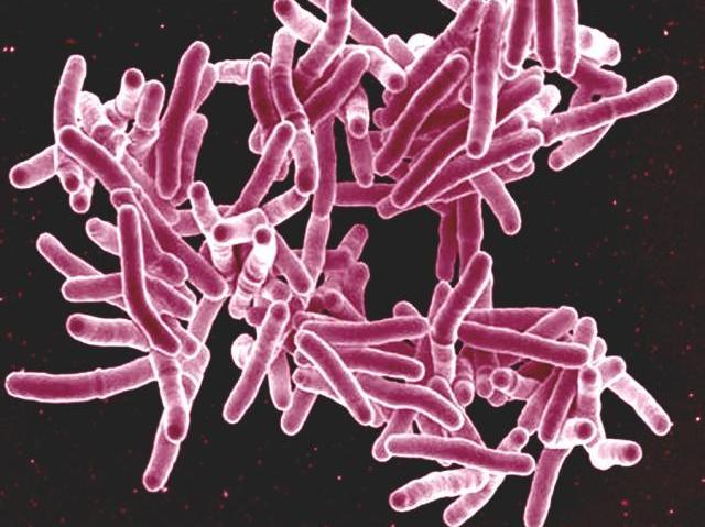 About a third of the world's population is thought to be infected with <em>Mycobacterium tuberculosis</em>, but only a small fraction of people get the disease.