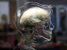 A real human brain on display at an exhibition in Bristol, England.