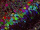 More than 100 years ago, Golgi staining on nerve cells opened the gates to modern neuroscience. Scientists recently developed the Technicolor version of Golgi staining, Brainbow, allowing more detailed reconstructions of brain circuits. More than 100 years ago, Golgi staining on nerve cells opened the gates to modern neuroscience. Scientists recently developed the Technicolor version of Golgi staining, Brainbow, allowing more detailed reconstructions of brain circuits.