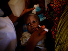 A child is immunized against polio at the health clinic in a farming village in northern Nigeria. The procedure involves pinching two drops of the vaccine into the child's mouth. For full protection, the child needs three doses, spaced out over time. A child is immunized against polio at the health clinic in a farming village in northern Nigeria. The procedure involves pinching two drops of the vaccine into the child's mouth. For full protection, the child needs three doses, spaced out over time.