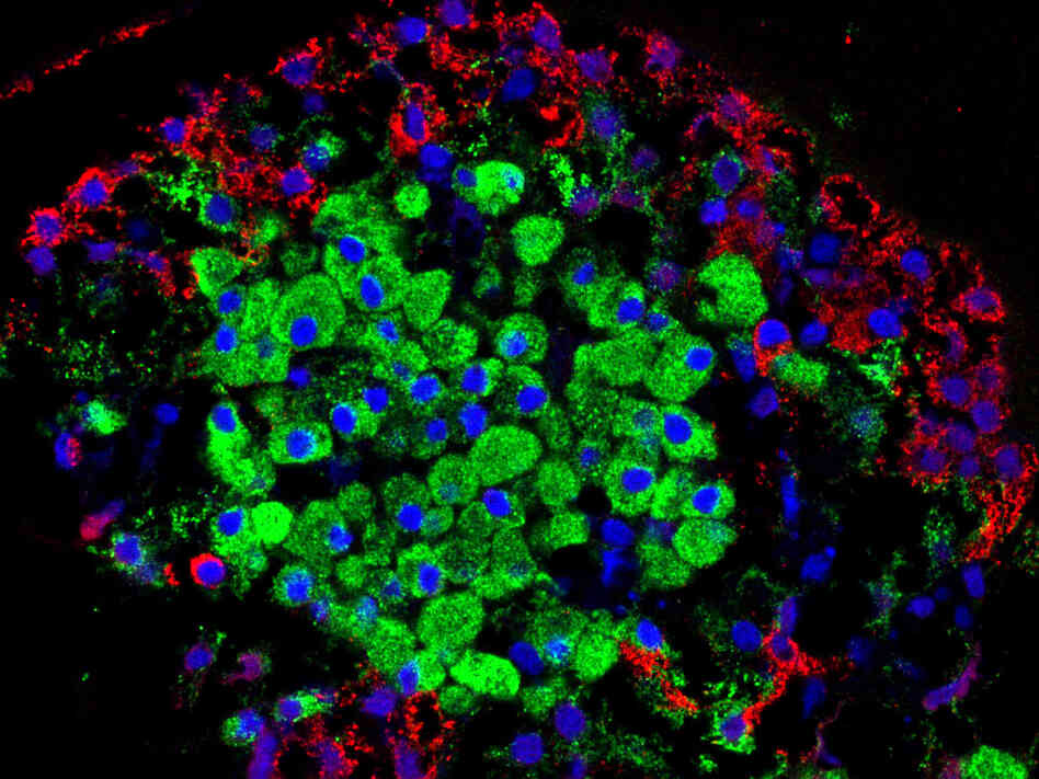 Researchers Find Hormone That Grows InsulinProducing Cells Shots