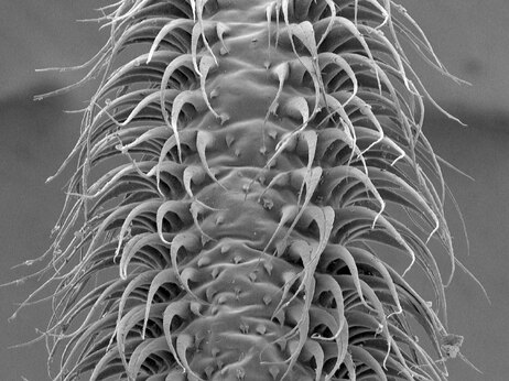 This scanning electron microscope image of the tongue of the Pallas' long-tongued bat shows how the hairs on the surface stand up to catch liquid, turning it into a "nectar mop."