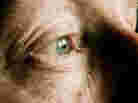 Age-related macular degeneration accounts for more than half of all cases of blindness in the United States.