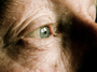 Age-related macular degeneration accounts for more than half of all cases of blindness in the United States.