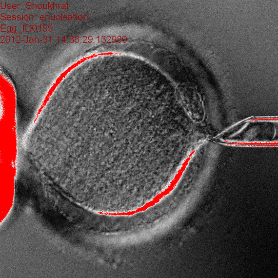 A scientist removes the nucleus from a human egg using a pipette. This is the first step to making personalized embryonic stem cells.