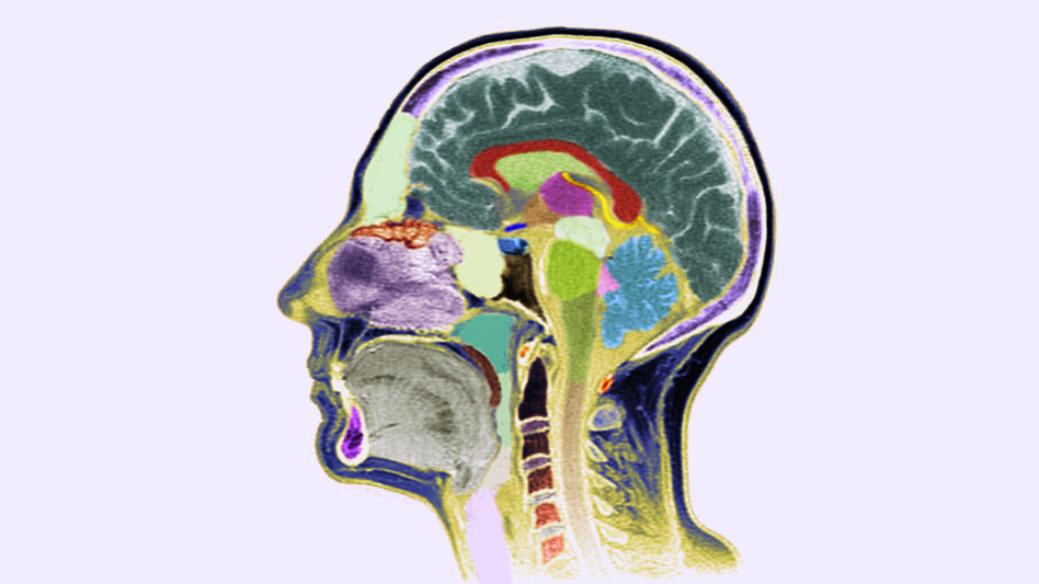 The brain's complexity has so far prevented psychiatry from developing lab tests for mental illness. The brain's complexity has so far prevented psychiatry from developing lab tests for mental illness.