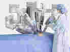 Many arms, one robot: the business end of the da Vinci system is seen in this media handout image from the manufacturer. Many arms, one robot: the business end of the da Vinci system is seen in this media handout image from the manufacturer.