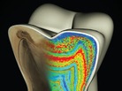 This model of a molar shows color-coded barium banding patterns that reveal weaning age. This model of a molar shows color-coded barium banding patterns that reveal weaning age.