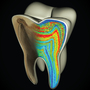 This model of a molar shows color-coded barium banding patterns that reveal weaning age. This model of a molar shows color-coded barium banding patterns that reveal weaning age.