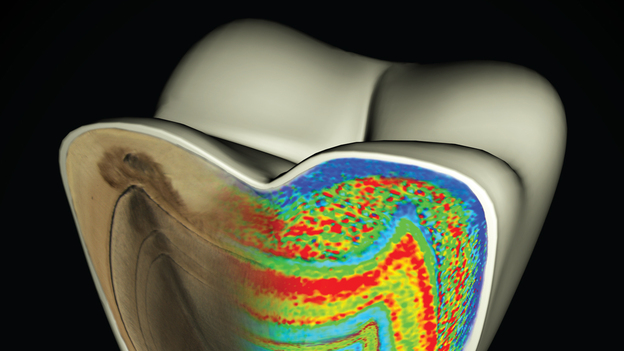 This model of a molar shows color-coded barium banding patterns that reveal weaning age.