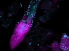 Fungi (cyan) surround a human hair within the skin. A study in the journal Nature shows the population of fungi on human skin is more diverse that previously thought. Fungi (cyan) surround a human hair within the skin. A study in the journal Nature shows the population of fungi on human skin is more diverse that previously thought.