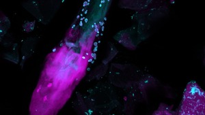 Fungi (cyan) surround a human hair within the skin. A study in the journal Nature shows the population of fungi on human skin is more diverse that previously thought.