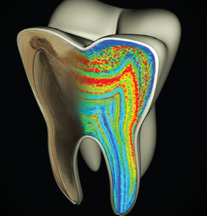 This model of a molar shows color-coded barium banding patterns that reveal weaning age. This model of a molar shows color-coded barium banding patterns that reveal weaning age.