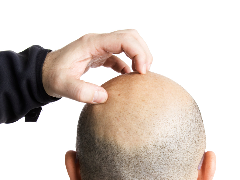 The origin of itch has confounded scientists for decades.