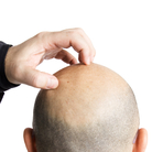 The origin of itch has confounded scientists for decades. The origin of itch has confounded scientists for decades.