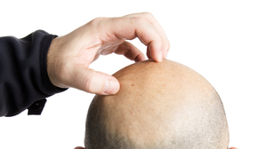The origin of itch has confounded scientists for decades. The origin of itch has confounded scientists for decades.