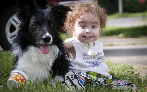 Kaiba Gionfriddo, who breathes with help from a splint created by a 3-D printer, plays with his family dog, Bandit, at his Youngstown, Ohio, home.