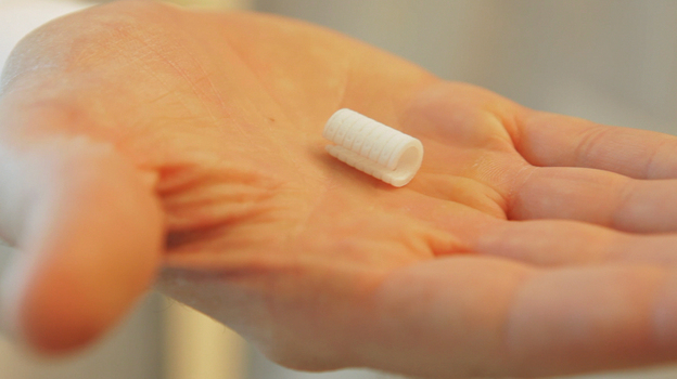 A file photo shows a device similar to the one doctors implanted to keep young Kaiba Gionfriddo's airway open.