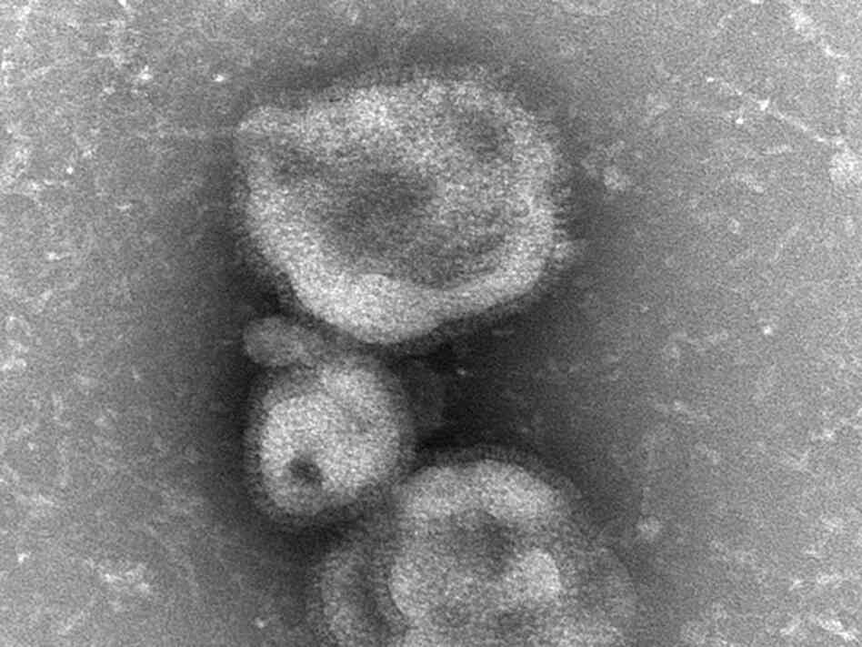 The H7N9 virus, as seen with an electron microscope. The H7N9 virus, as seen with an electron microscope.