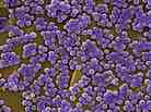 To fight antibiotic-resistant staph germs like these, a study suggests disinfecting the skin of all intensive care patients.