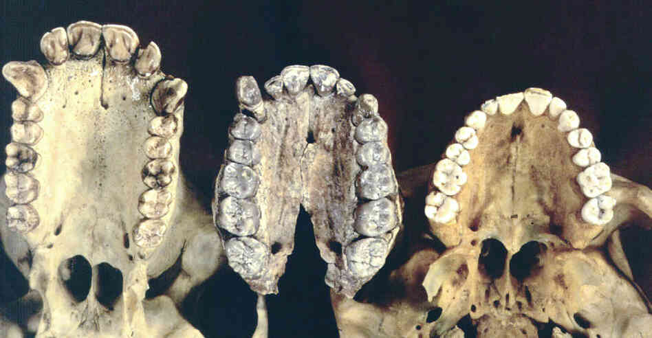 Nom Nom Nom: From left, a cast of teeth from a chimpanzee, Australopithecus afarensis and a modern human. We switched from an ape-like diet of fruits and leaves about 3.5 million years ago, according to fresh research. There's evidence that meat-eating came about a million years or so later. Nom Nom Nom: From left, a cast of teeth from a chimpanzee, Australopithecus afarensis and a modern human. We switched from an ape-like diet of fruits and leaves about 3.5 million years ago, according to fresh research. There's evidence that meat-eating came about a million years or so later.